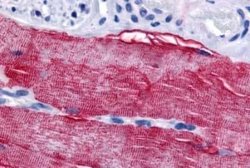 GRK5 Antibody, Novus Biologicals 50 &mu;g; Unconjugated:Antibodies, Polyclonal